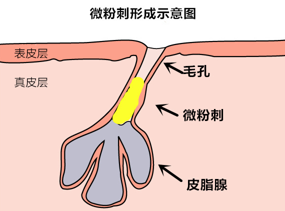 <a  data-cke-saved-href=http://www.qudou86.com/tag/lianshang/ href=http://www.qudou86.com/tag/lianshang/ target=_blank ><a  data-cke-saved-href=http://www.qudou86.com/tag/lian/ href=http://www.qudou86.com/tag/lian/ target=_blank ></a></a><a  data-cke-saved-href=http://www.qudou86.com/tag/bihexingfenci/ href=http://www.qudou86.com/tag/bihexingfenci/ target=_blank >պ<a  data-cke-saved-href=http://www.qudou86.com/tag/fenci/ href=http://www.qudou86.com/tag/fenci/ target=_blank >۴</a></a>һ㶼ʲô<a  data-cke-saved-href=http://www.qudou86.com/tag/yuanyin/ href=http://www.qudou86.com/tag/yuanyin/ target=_blank >ԭ</a>